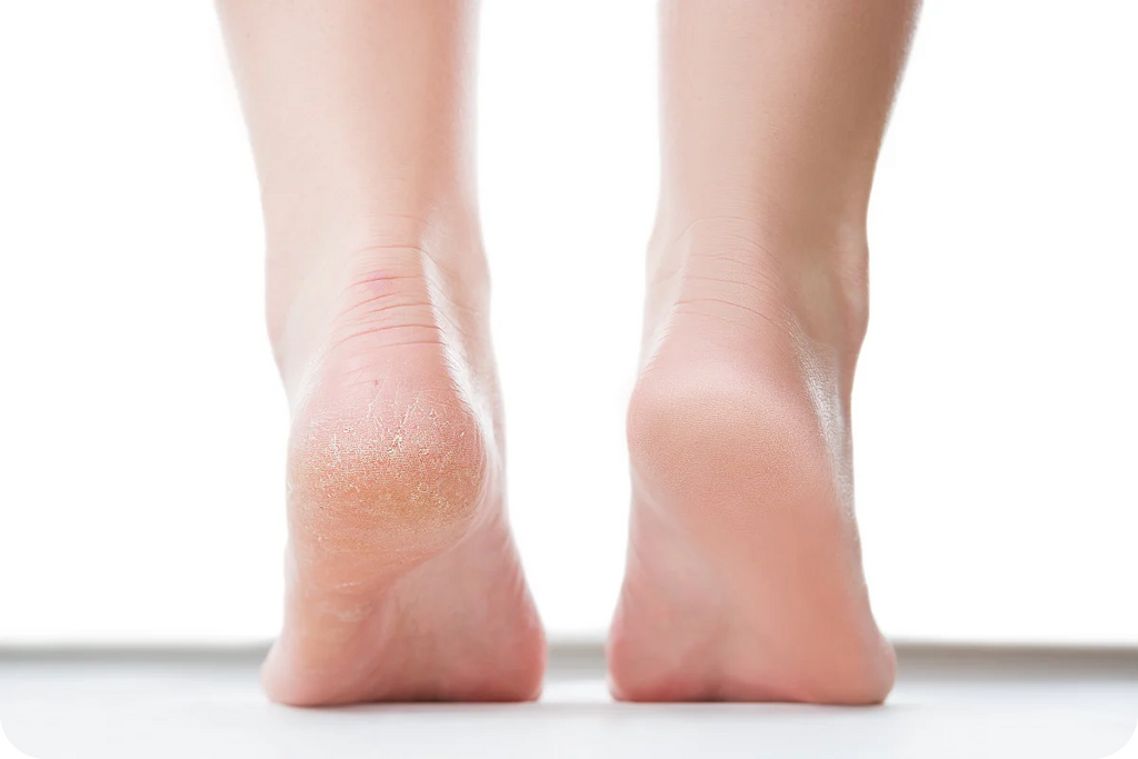 Pack Floraux Douceur Pieds